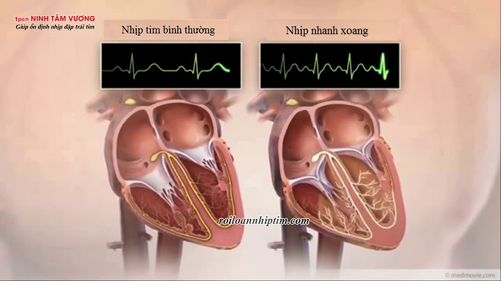 Nhịp xoang bình thường là bao nhiêu năm 2024