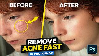 How to Remove Acne and Blemishes in Photoshop Easy Tutorial screenshot 4
