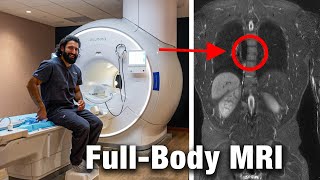 I Did a $2,500 Prenuvo MRI Scan. My Surprising Results
