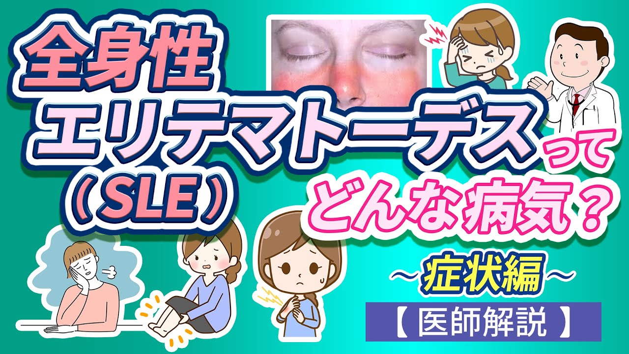 全身性エリテマトーデス（SLE）ってどんな病気？ ~ 症状編 ~【医師解説】