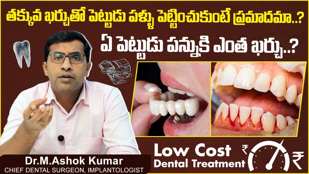 ఏ పెట్టుడు పన్నుకి ఎంత ఖర్చు?  || Cost of Artificial Teeth in Hyderabad || Eledent Dental Hospitals