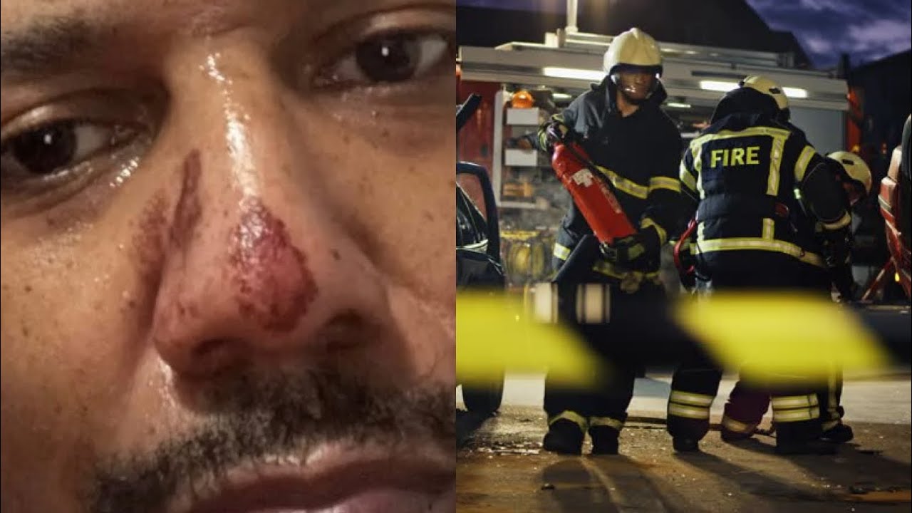 🔴BREAKING NEWS! JUELZ SANTANA INVOLVED IN SERIOUS CAR ACCIDENT!