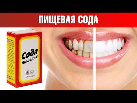 7 неожиданных свойств пищевой соды, о которых вы точно не знали🔥