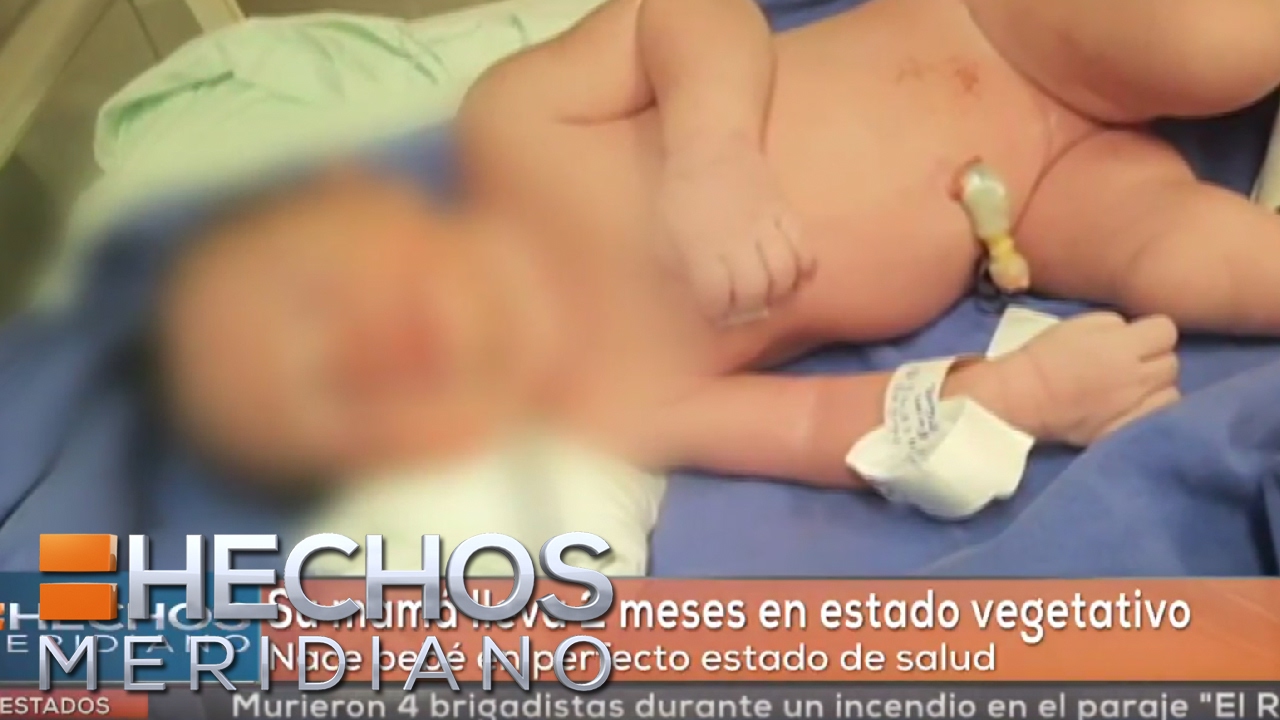 Nace bebé sana, estando su madre 2 meses en estado de coma seguridad alimentaria