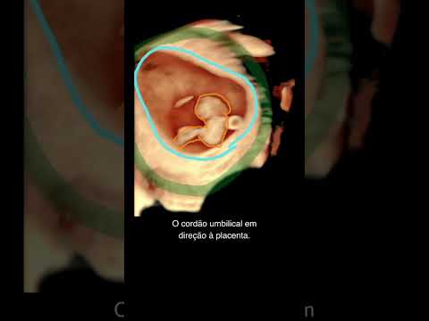 8 недель беременности - 3D УЗИ #беременность #gestante #bebe #ultrassom #