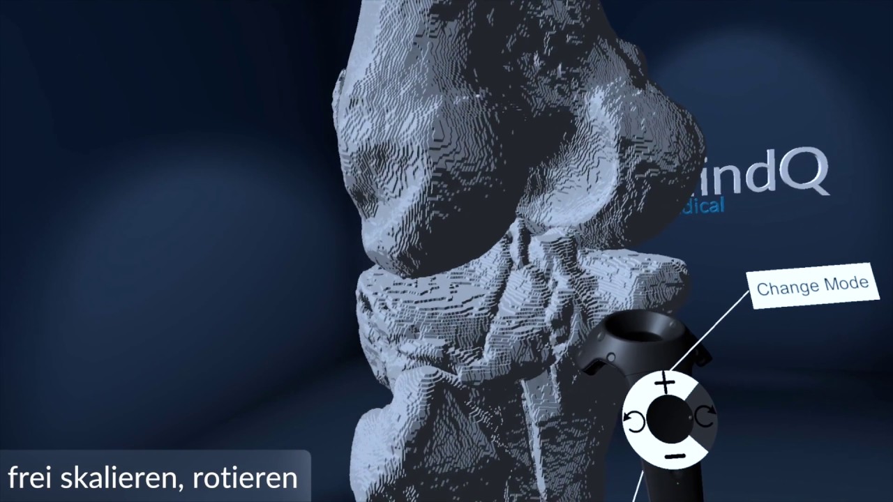 mQm - Virtual Reality in der Operationsplanung basierend auf MRT/CT-Daten