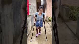 Lolicc in black stockings using crutches to help walk despite her weak legs