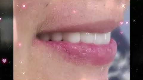 Replacement of missing teeth with zirconia crowns and bridges