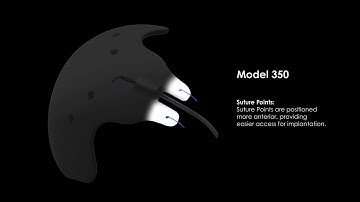 Ahmed ClearPath® Model 350 Animation
