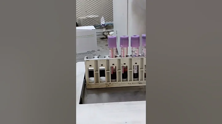 Advanced autoloader hematology (CBC) analyser Mindray BC 6200 #hematology #cbc