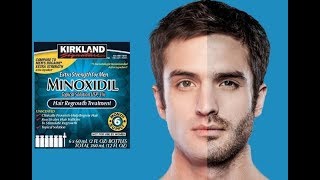 Minoxidil Москва