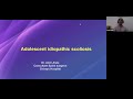 TO PASS DNB/MS ORTHOPAEDICS - CASE 108 - ADOLESCENT IDIOPATHIC SCOLIOSIS - DR. AMIT JHALA