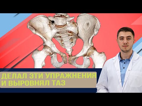 От перекоса таза. Стал ровнее ходить и не чувствовать боль в спине