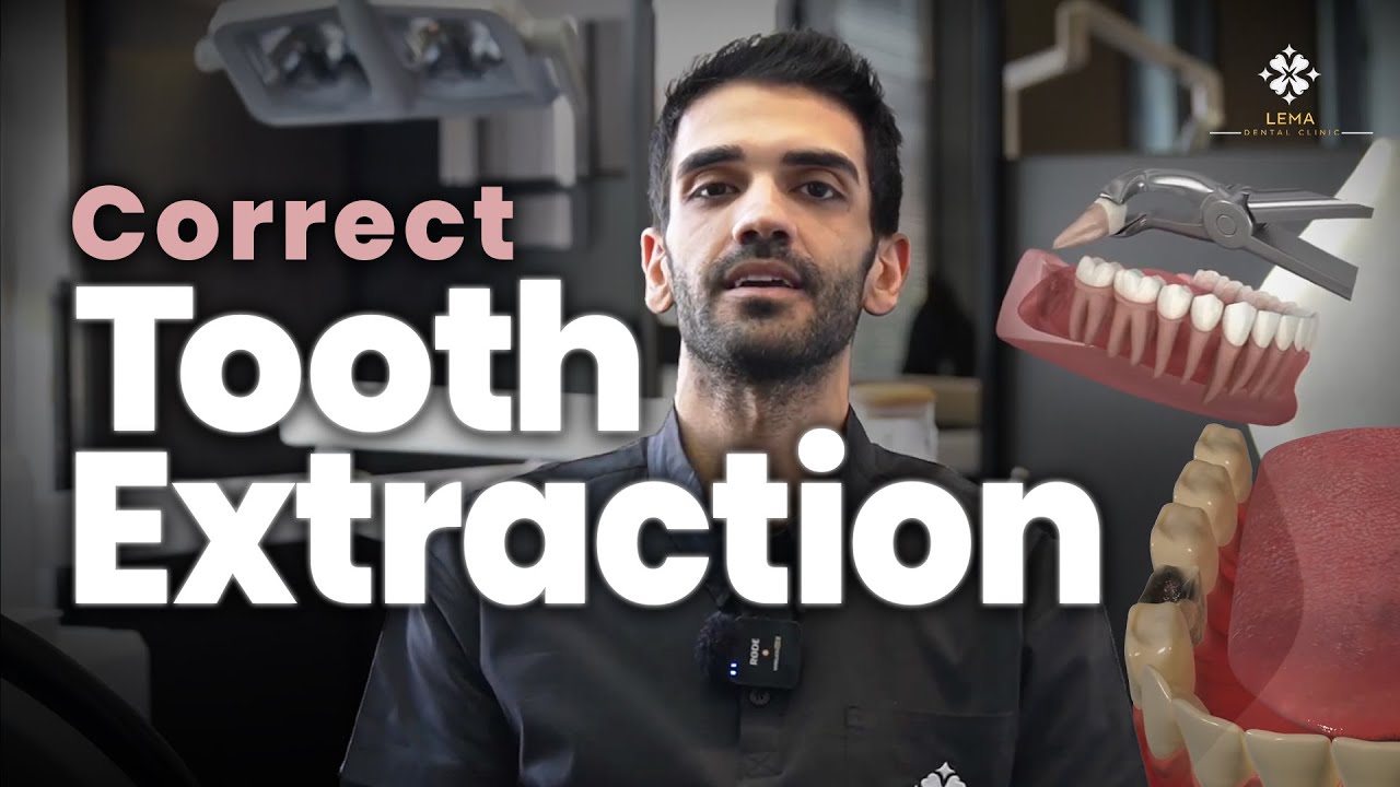 🤍 How to Extract a Tooth? How is Tooth Extraction Performed?