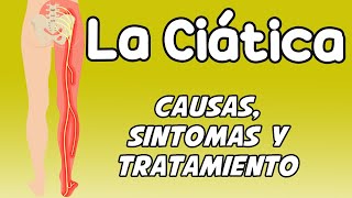 LA CIÁTICA, Causas, síntomas, diagnóstico y tratamiento
