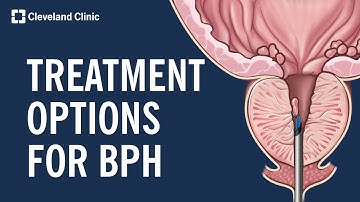 Treating Benign Prostatic Hyperplasia (BPH)