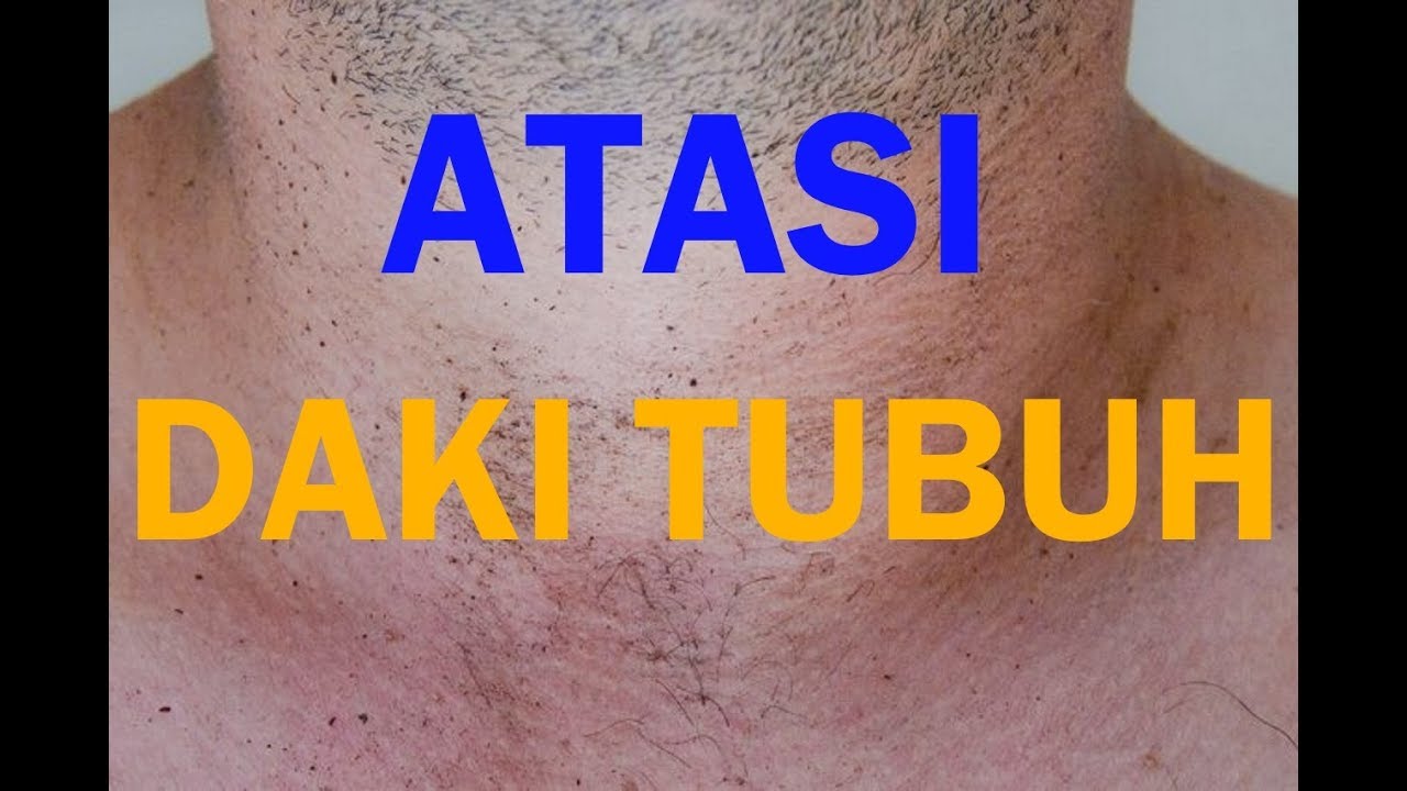 Cara Menghilangkan Daki Pada Tubuh 