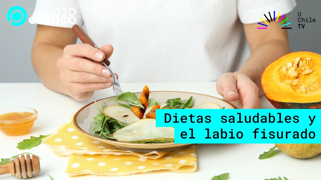 Con Ojo Clínico - CAP 63: Dietas saludables y el labio fisurado