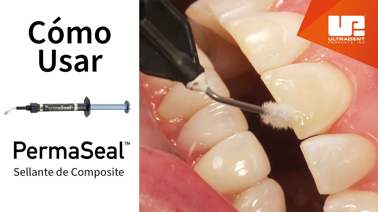 Cómo usar el sellante de composite PermaSeal™ Paso a paso. YouTube