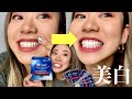 【超美白】Crest ホワイトニングシールが鬼やばい。