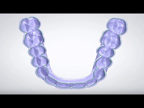 3Shape Dental System - Splint Design