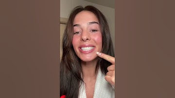 Byte Update 🦷 (1 mo in!)