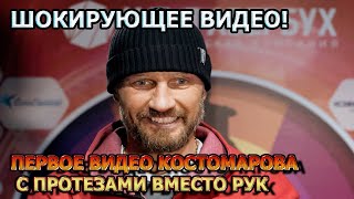 ШОКИРУЮЩЕЕ ВИДЕО! Роман Костомаров показал вместо рук протезы