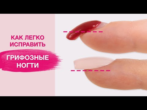 Исправляем КЛЮЮЩИЕ ногти