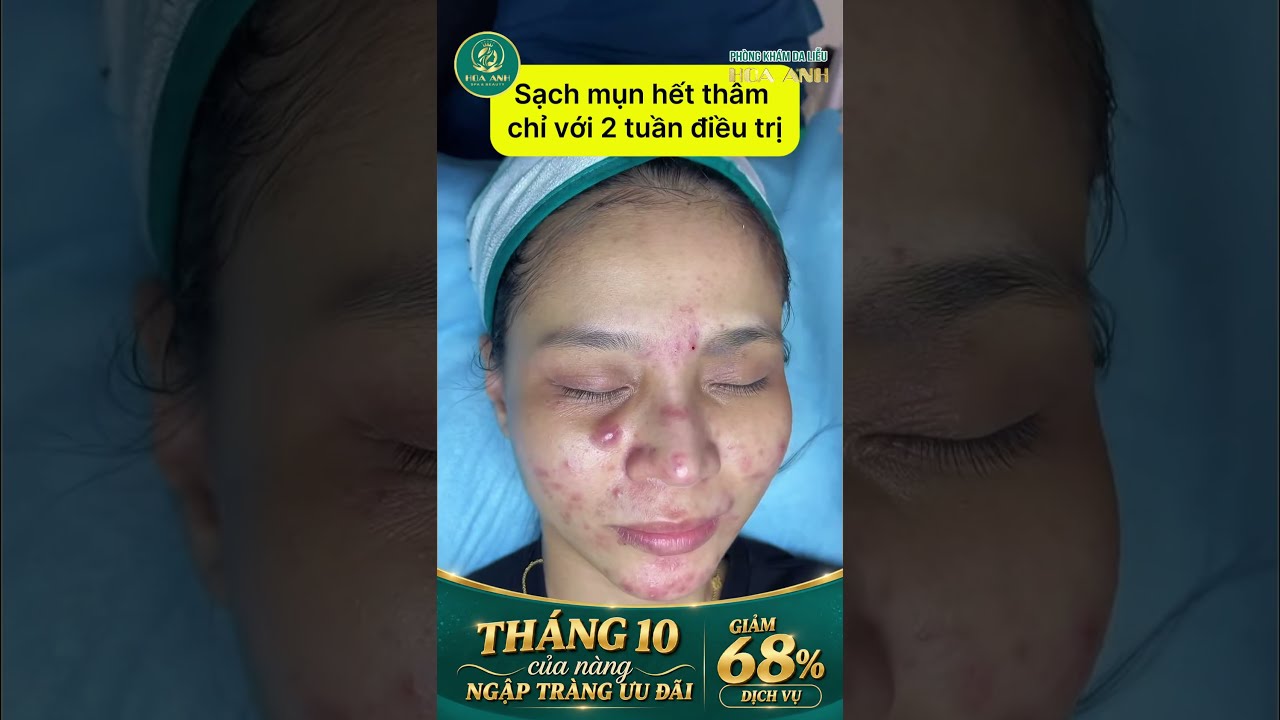 Original Title & Thumbnail
