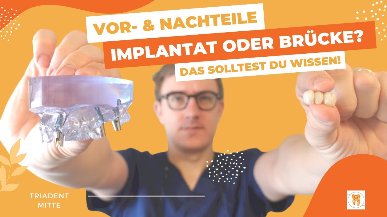 Was Ist Besser Implantat Oder Brcke
