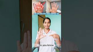 Do you know this little move👉#handexercises #wristexercises #fingerexercises #physiotherapy #shorts