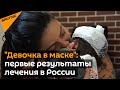 Мама "девочки в маске” показала первые результаты ее лечения в России