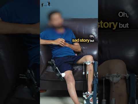 My Height Lengthening Journey: A Personal Transformation Story