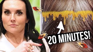 How to GET RID of LICE in 20 Minutes!! | Lice Clinics of America Active Rinse