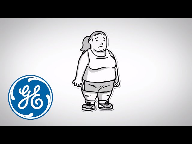 Watch Indirect Calorimetry in Complex Cases – Morbid Obesity, Sepsis | GE Healthcare on YouTube.