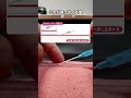 【新人看護師向け】逆血の仕組みとチェックポイントの意味 #shorts