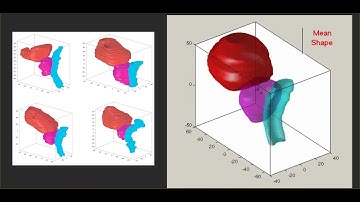DIP Lecture 25: Active shape models