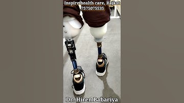 Bilateral Amputee Able To Walk Again | Inspiring | Walk Again