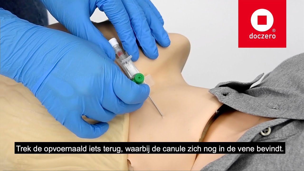 Inbrengen infuuscanule intraveneus vena jugularis externa | Doczero E-learning