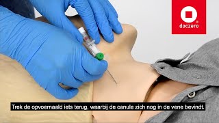 Inbrengen Infuuscanule Intraveneus Vena Jugularis Externa Doczero E-Learning