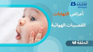 أعراض التهاب القصيبات عند الطفل