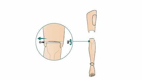 Resusci Anne Simulator - How to attach IO legs