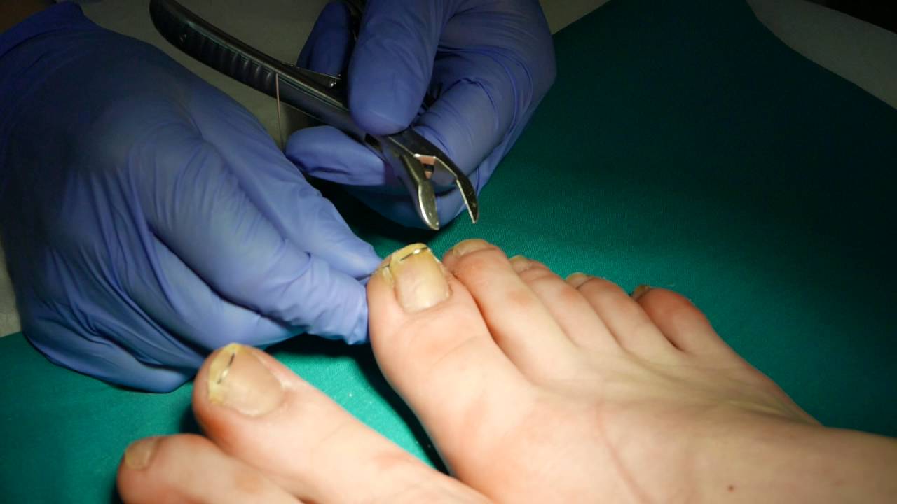 Telli Nail Art Tırnak Trendi Telli Nail Art Tırnak Trendi