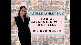 Full Facial Balancing with Hyaluronic Dermal Filler (2.5 Syringes) | Soft Lifted Results