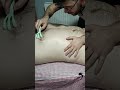 TURKISH MASSAGE FOR PAIN IN CHEST, ARM AND ABDOMINAL AREA #satisfying #relaxing #asmr #shorts