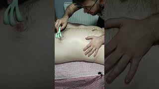 TURKISH MASSAGE FOR PAIN IN CHEST, ARM AND ABDOMINAL AREA #satisfying #relaxing #asmr #shorts