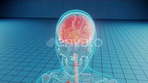 Brain Damage in Human Body | Motion Graphics - Envato elements