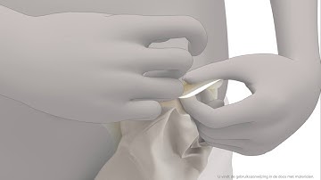 Instructie SenSura® Mio Convex Flip 1 delig gesloten