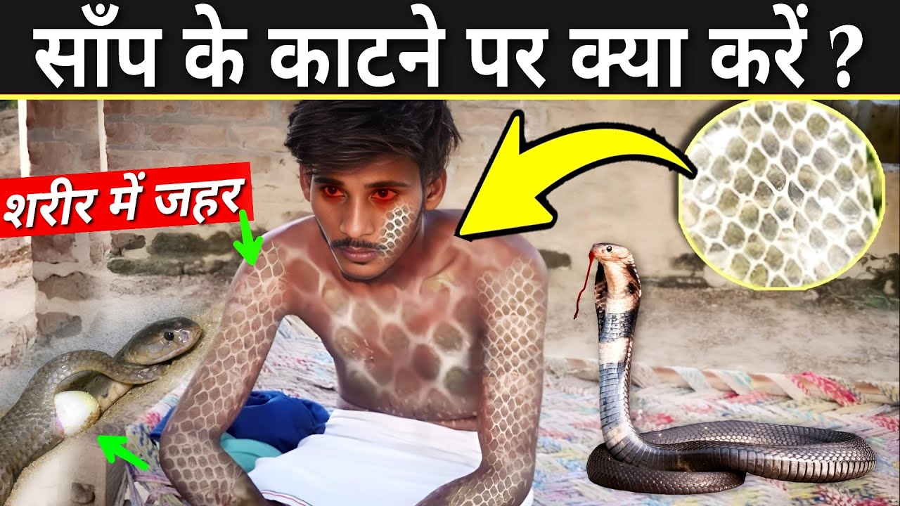 snake-bite-first-aid-in-hindi-what-if