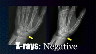 Imaging evaluation of upper extremity injury